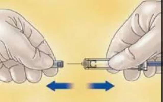 皮下注射低分子肝素钙的护理