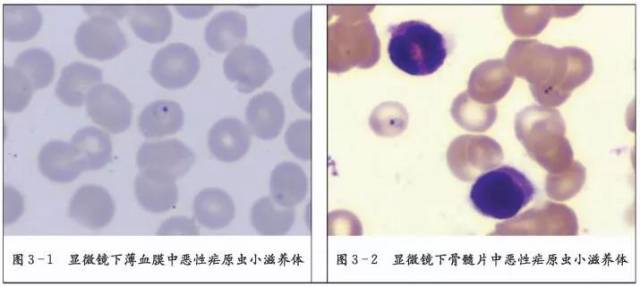 它包括理论上学习如何制作合格的血片,如何识别显微镜下的疟原虫,如何