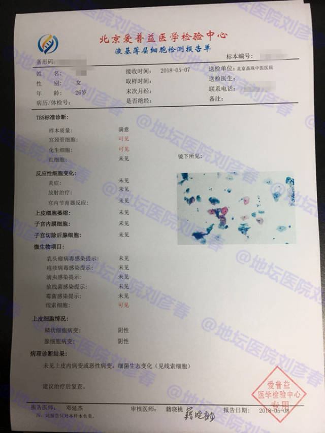 tct结果显示ascus该怎么办?