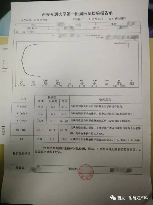 带你认识血栓弹力图