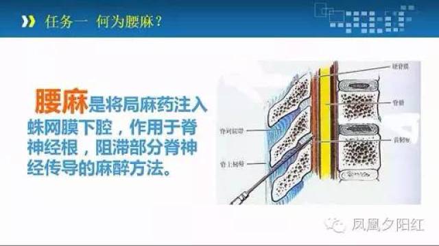 【养老护理系列十五】| 腰麻病人术后出现头痛,不知道