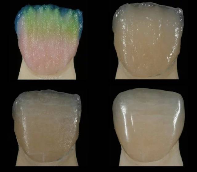 牙齿各种颜色,形态欣赏