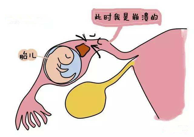 输卵管堵塞有什么症状?