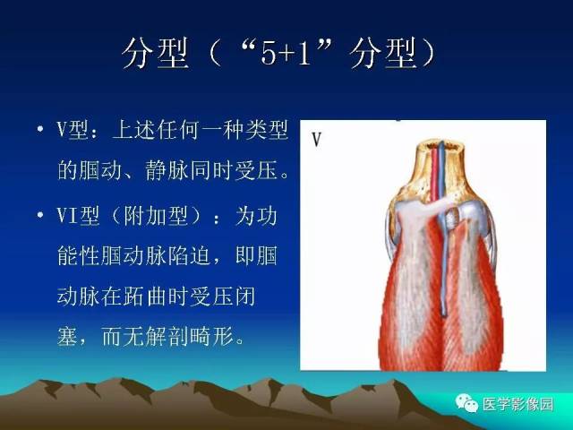 腘动脉陷迫综合征影像学诊断 | 影像天地