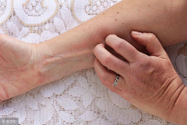 手上湿疹痒,1种野菜是湿疹福音,用了湿疹消失不再来