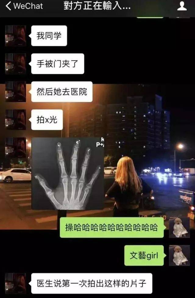 一张搞笑的x光趣图