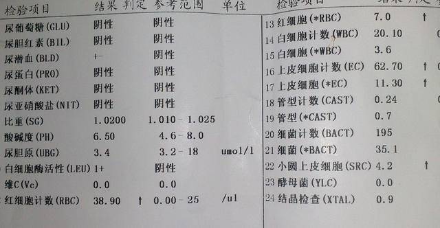 产检时候需留意,2种产妇需要反复尿常规检查,不是说说