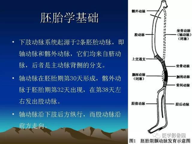 腘动脉陷迫综合征影像学诊断 | 影像天地