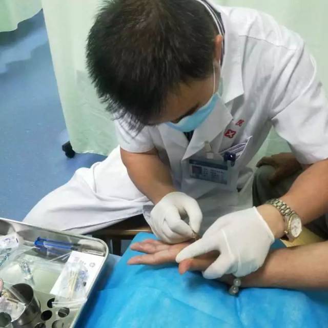 得了腱鞘炎怎么办?甘肃省二院中医科运用小针刀治疗效果显著