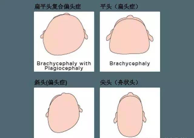 原来是这五个坏习惯,让你的宝宝越长越丑了