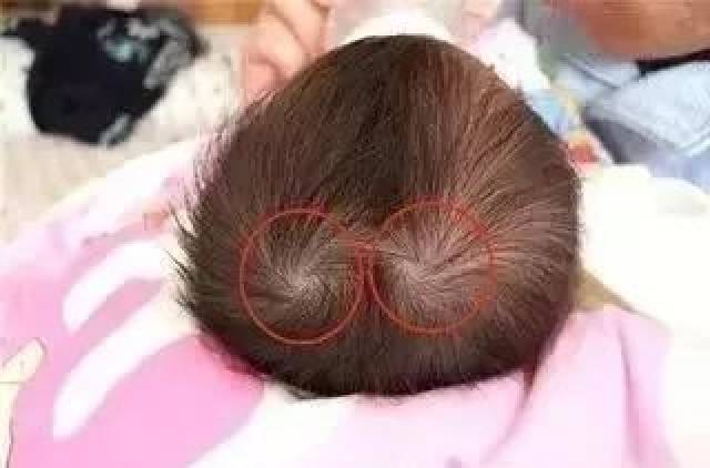 有两个旋的孩子就是聪明?