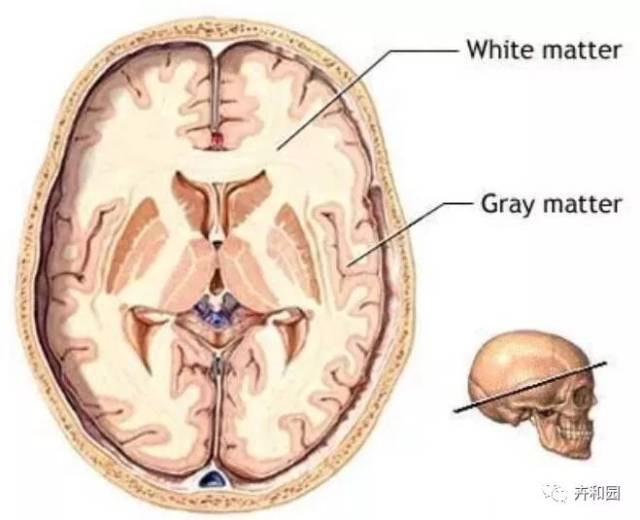 灰质和白质对我们的思考力很重要!