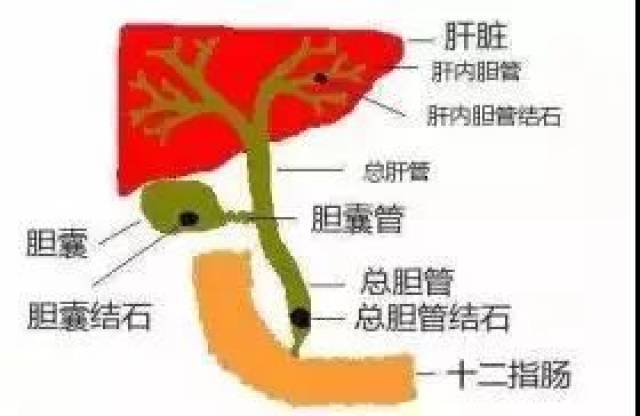 【热点】婴儿胆汁淤积症