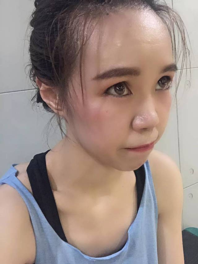 175cm设备:65kg▲让人累觉不爱的刷脂体重▲刷脂毒素选有氧建议瘦脸针肉毒杆菌器械图片