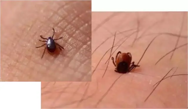 (图片来源于网络) 令人触目惊心的是,被蜱虫咬伤的案例并不是少数,小