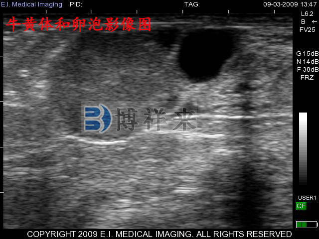 牛用b超兽用b超观察牛卵泡发育的过程