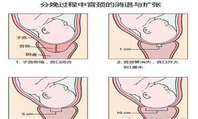 生孩子时,"开十指"就是十个指头全塞进宫口,这是真的吗?