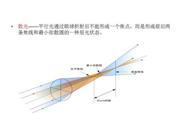 什么是散光?