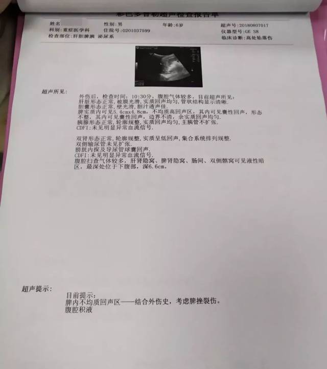 肺ct示:左侧腹部骨折,左侧气胸,左肺挫裂伤;肋骨ct示:脾大,脾周围模糊的问路英语ppt课件图片