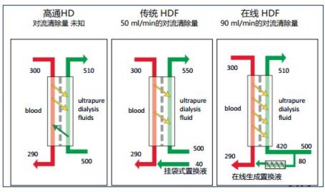 高容量在线血液透析滤过(hdf)的临床证据(上)