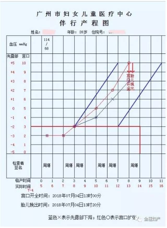 过去的研究没有把产程长短和宫颈检查次数这两个变量完全分开.