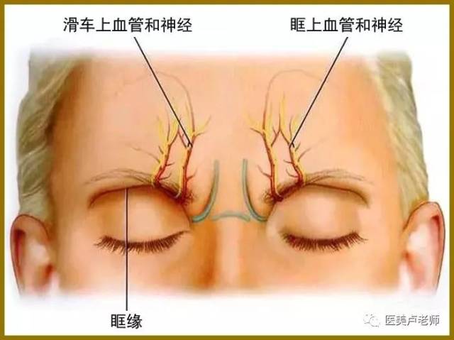 皱眉肌纹的深面是滑车上动脉