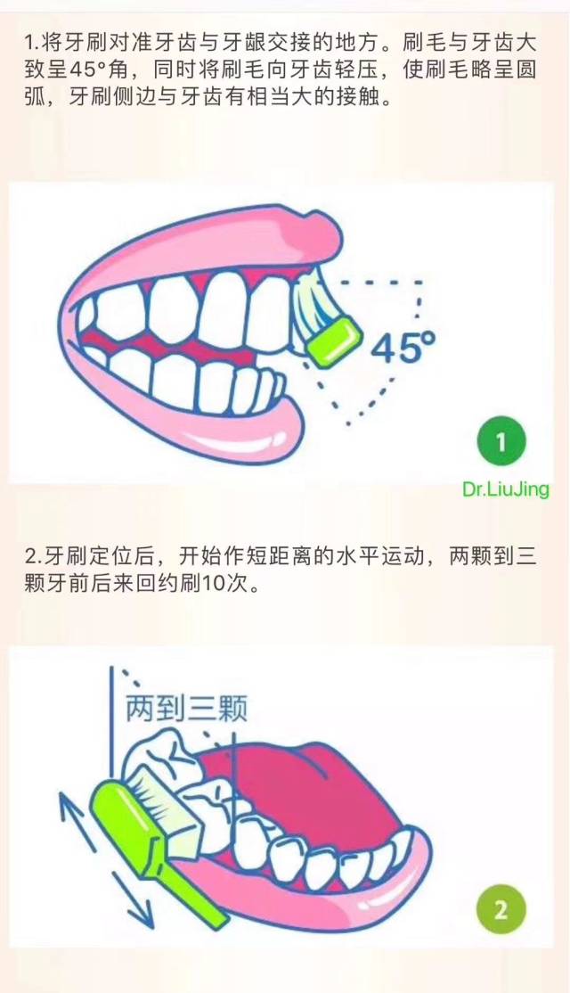 巴氏刷牙法详细图解