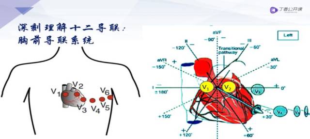 如图所示,v1,v2叫右胸导联,v1在右室流出道,v2右室前壁;v3-4叫移行