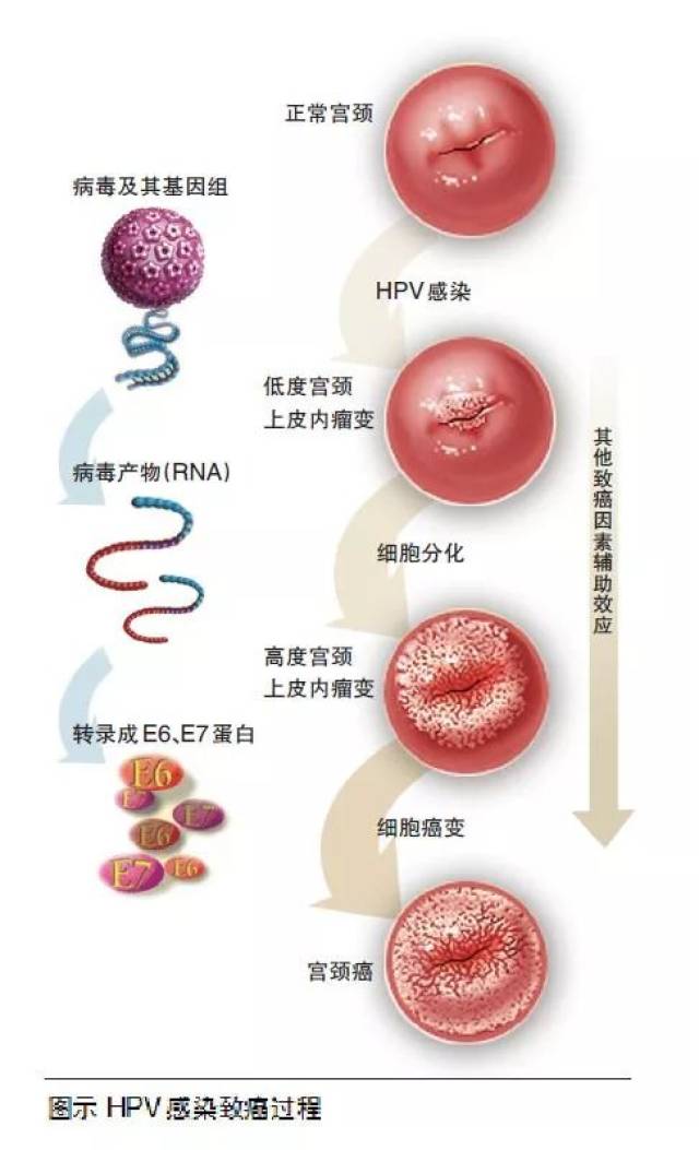 hpv,中文名字叫做人乳头瘤病毒.
