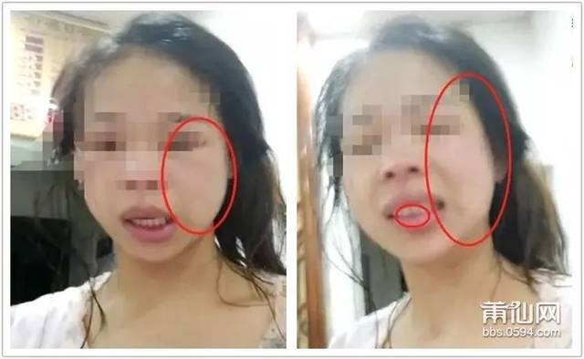 视频:莆田美少妇哭诉被老公家暴,脸都被打肿了