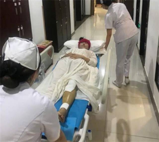 60岁杨丽萍练舞骨折四处,做完手术3天绑石膏做高抬腿不费劲
