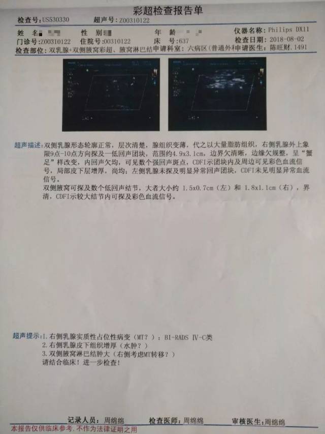 【学科建设】晋江市安海医院多学科保驾护航成功实施局部晚期乳腺癌