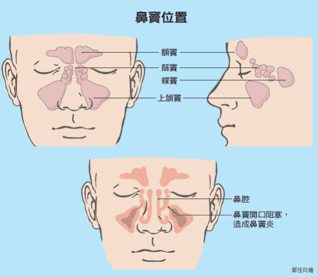 林更新被传已婚,起因是他入院做了个鼻窦炎手术.