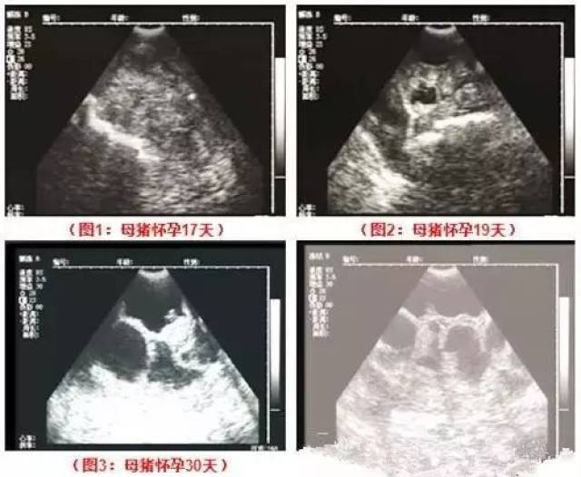 显示膀胱前方的子宫角区域声像图