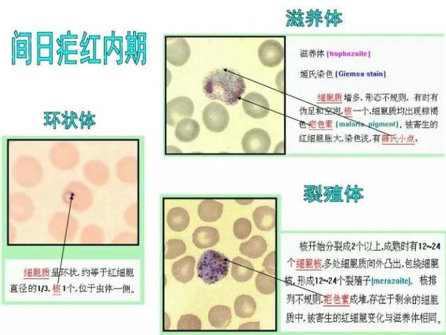 狼疮细胞 搜狐网