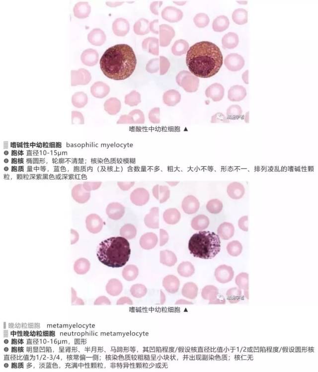 狼疮细胞 搜狐网