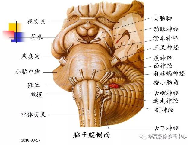 脑干的解剖与临床综合征
