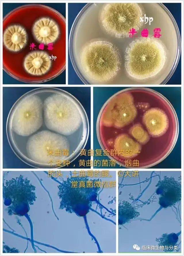 匍匐菌丝:沿培养基表面生长并延伸的水平