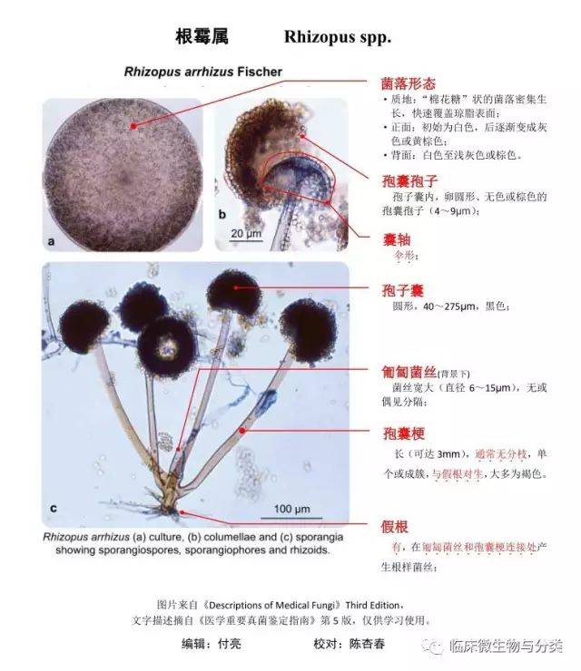 接合孢子:是接合菌的特征,通常指大的,暗色,壁粗糙