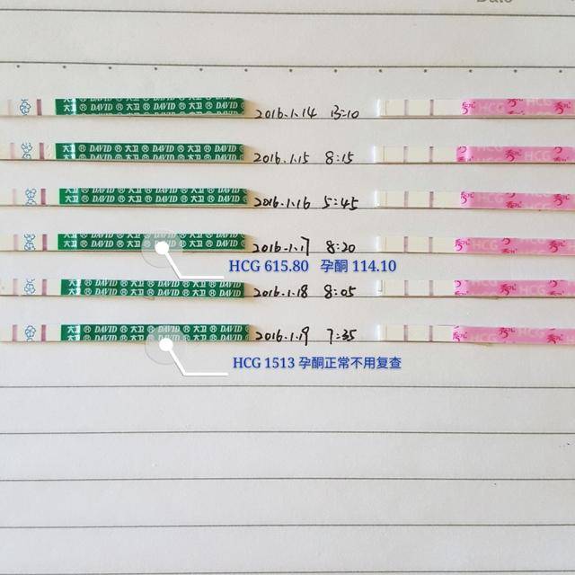 白带拉丝后多久排卵?升级的详细方法传你好孕