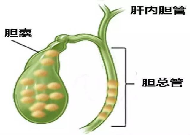 胆囊切除的受益远远高过不切除的收益,它避免了继发胆总管结石,急性