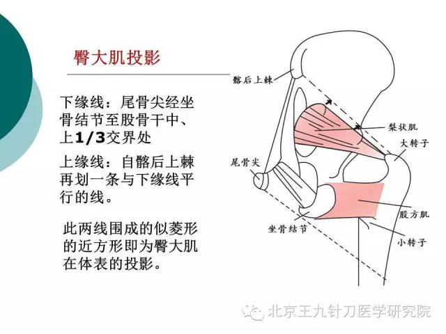 腰臀部软组织损伤的针刀治疗