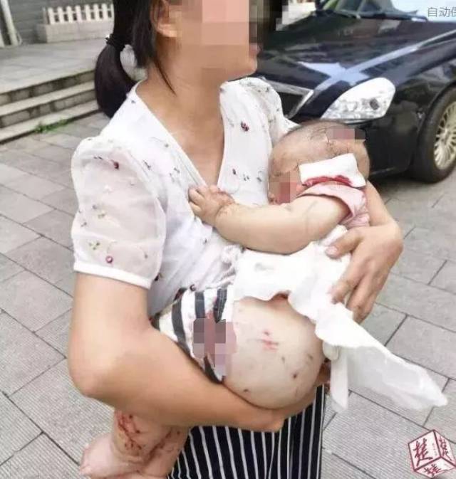 2岁男童被狗咬掉睾丸:"我家狗不咬人"到底害了多少人?