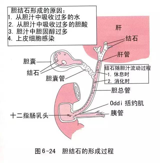 慢性胆囊炎的症状都有