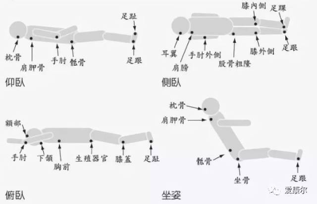 哪些部位容易发生压疮 这个跟老人长期处在什么样的位置有关.