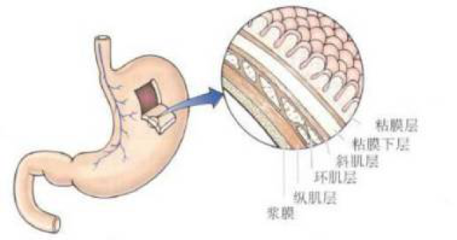 胃壁解剖结构