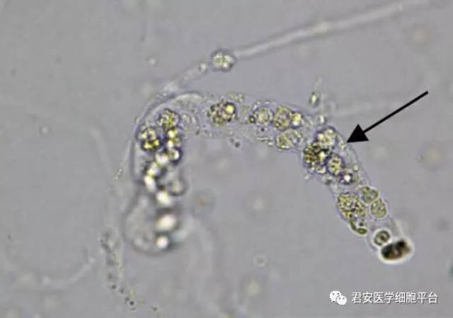 白细胞管型