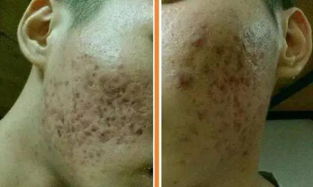 戒掉撸,天天运动中穿腿什么短粗女生图片