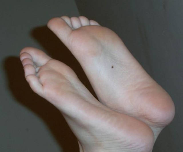 长在脚上的痣相都代表着什么含义