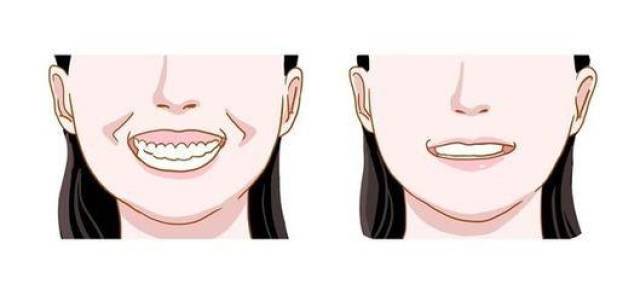 牙齿矫正中的深覆合和深覆盖有什么区别呢?